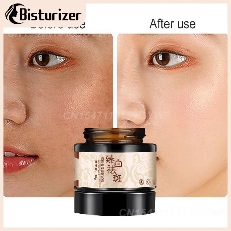 

30g powerful whitening freckle cream chinese plant face cream remove freckles and dark spots mild skin whitening cream