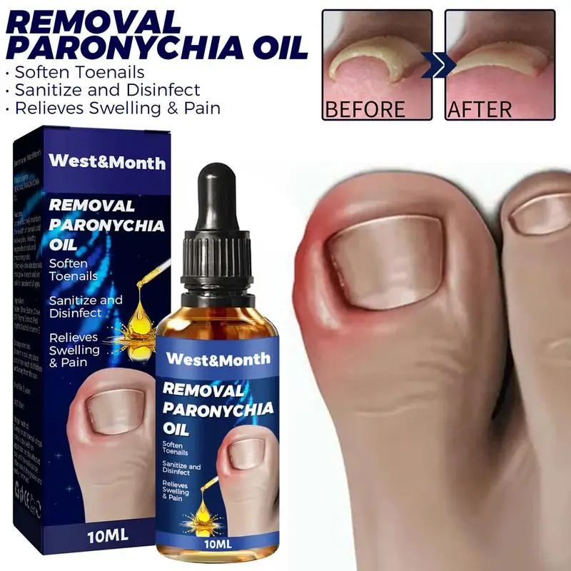 

10ml Nail Helper Ingrowth Toenail Correction Oil Ingrown Toenail Corrector Softener Drops For Ingrowth Toenail Easy Trimming