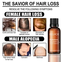 eelhoe rosemary hair oil scalp massage treatment stimulates hair follicles hair nourishing liquid strengthens hair