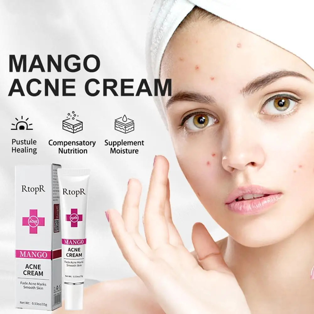 

Acne Cream Acne Mark Removal Acne Mild Repair Damaged Skin Hydration Nourishment Rejuvenation Face Brightening Skin Care