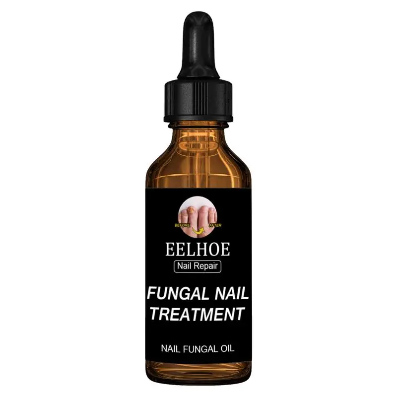 

Раствор для обновления ногтей натуральный мощный средство для ухода за ногтями восстанавливает внешний вид обесцвеченных или поврежденных ногтей