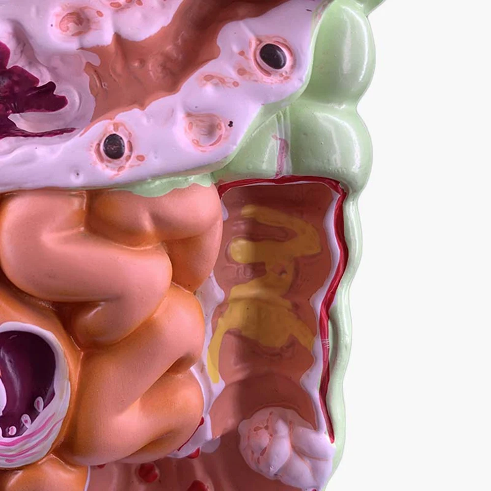 Модель пищеварительной системы человека Анатомия желудка Толстая кишка Cecum Rectum
