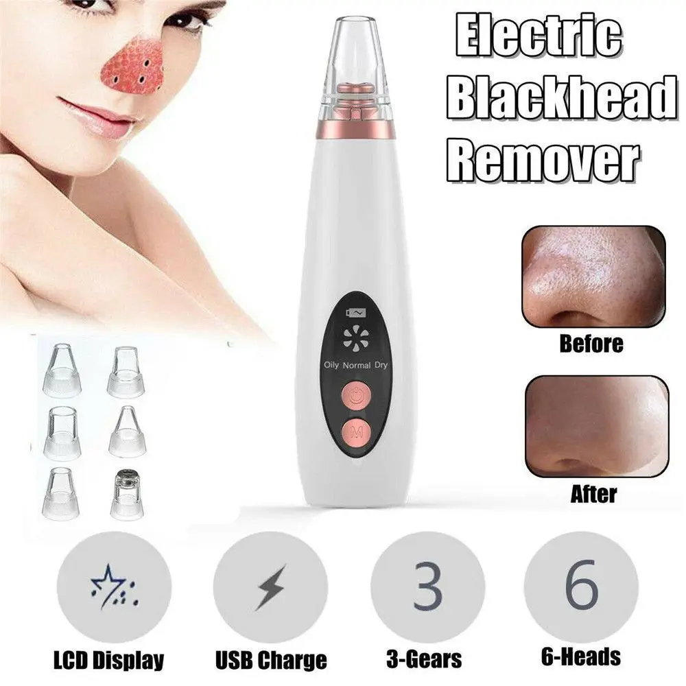 

Электрический вакуумный прибор для удаления черных точек на лице