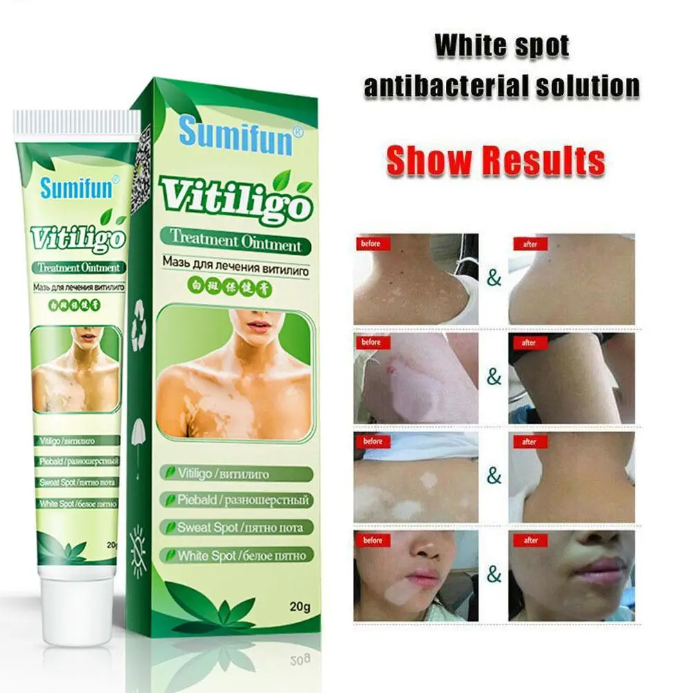 Новинка мазь для лечения заболеваний Vitiligo Leukoplakia крем восстановления болезней
