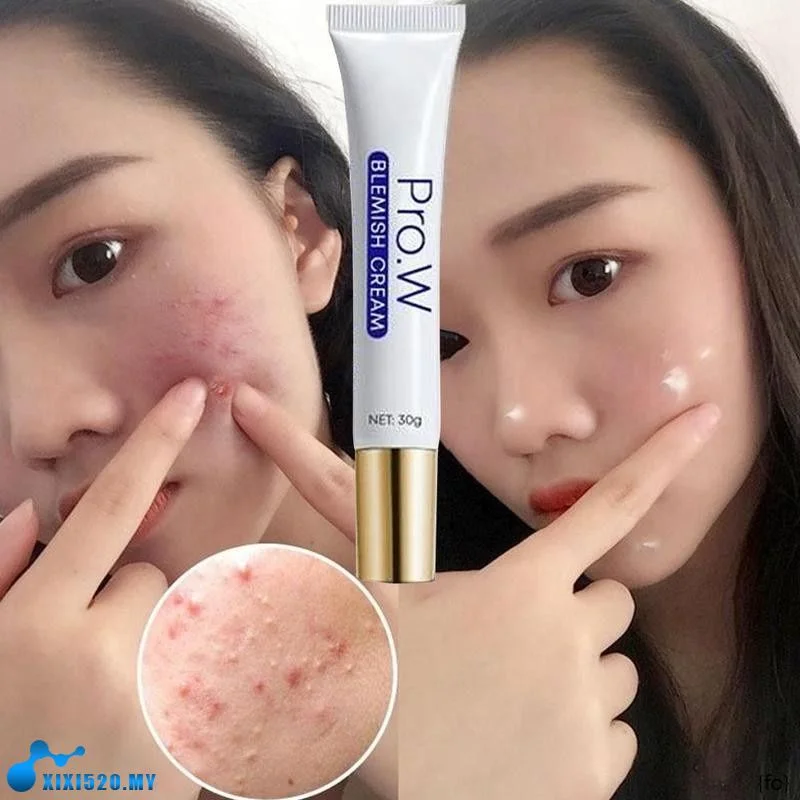 

Pro.W Blemishs Cream Effective Freckle Cream Remove Dark Spots Witening Cream Fade Acne Scars Melasma Anti-Aging Skin Lightening