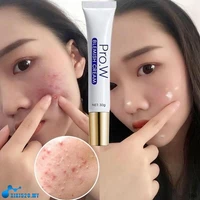 pro w blemishs cream effective freckle cream remove dark spots witening cream fade acne scars melasma anti aging skin lightening