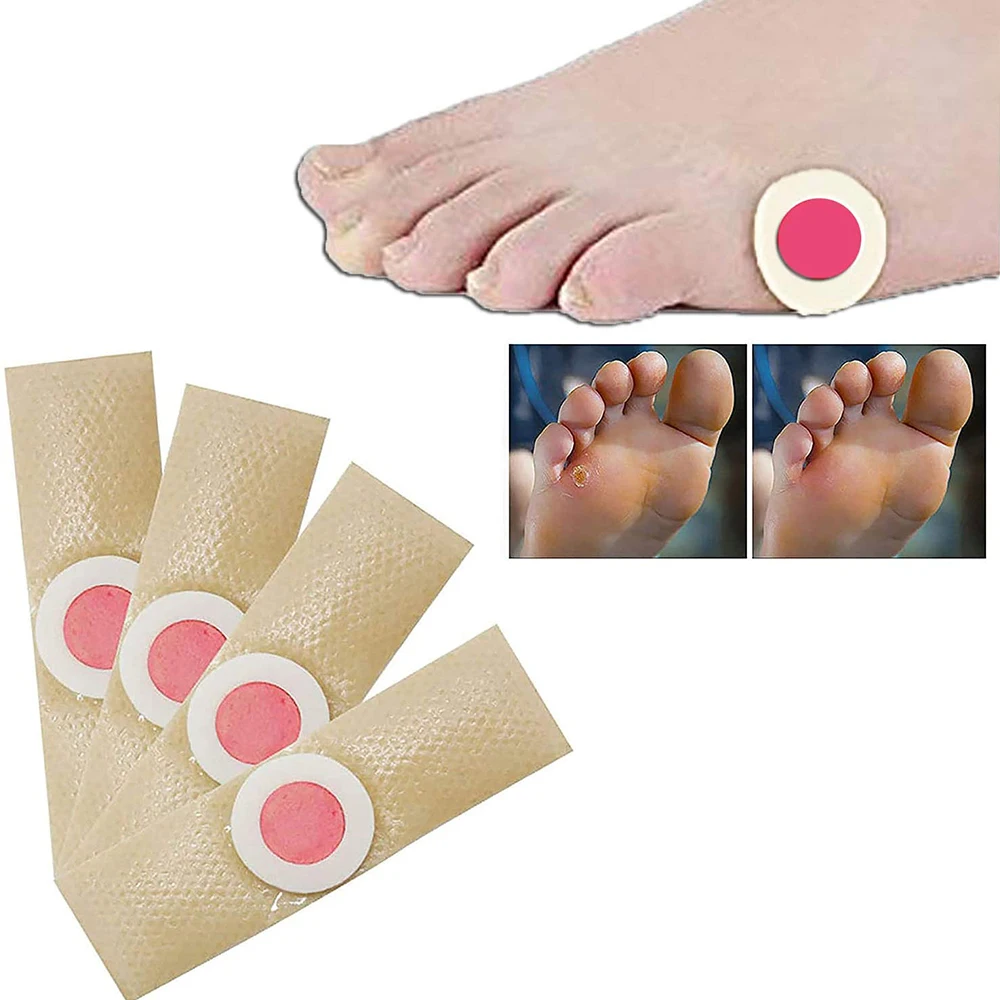 

24PCS Medical Corn Plaster Foot Corn Removal Warts Thorn Detox Adhesive Patches Feet Care Calluses Callosity Clavus Remove Tool