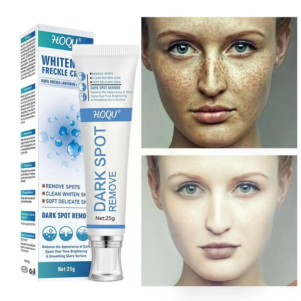 

Whitening freckle cream Effectively Removes Dark Spots Chloasma Spots Brightening Spots Skin Freckles Care Sun Age Whitenin E5X3