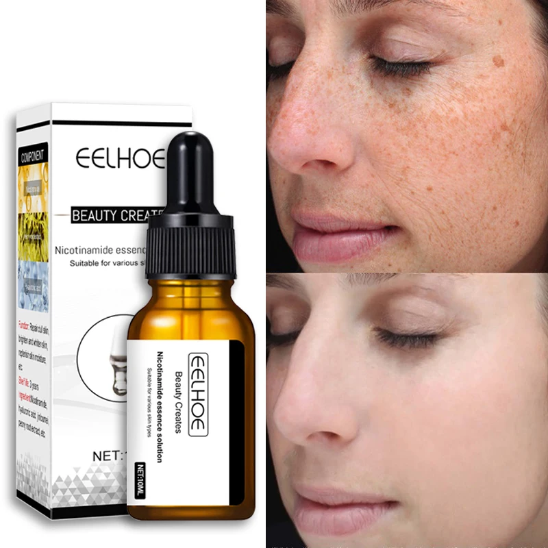 

Brighten Skin Tone Delicate Pore Serum Niacinamide Whitening Freckle Essence Moisturizing Get Rid of Dark Spots Correction Serum