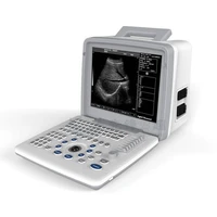 12 inch black white china portable ultra hd ultrasound machine price