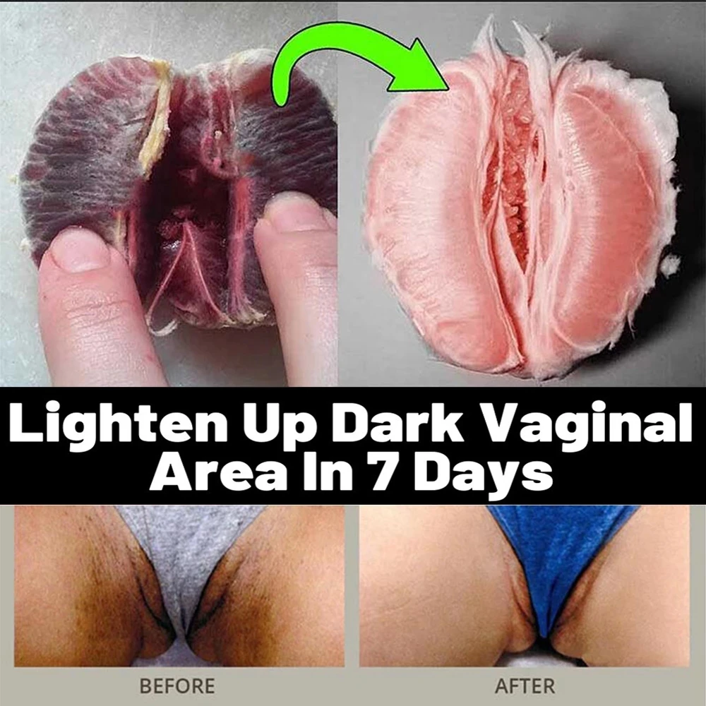 

Whitening Natural Ingredients for Dark Skin lightening dark spots Corrector Remover for Face Hyperpigmentation Melasma Treatment