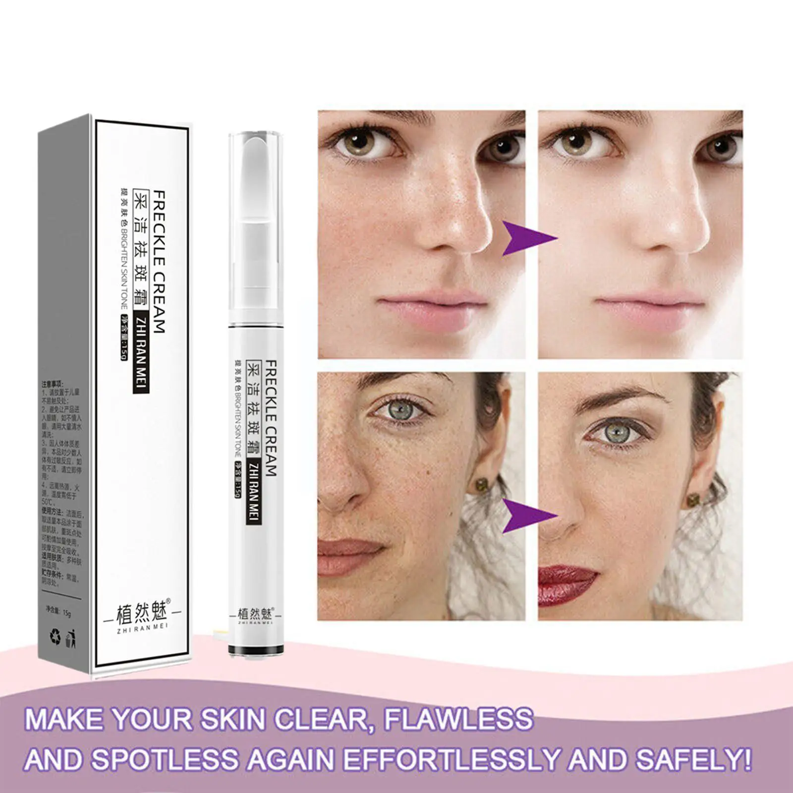 

Freckles Whitening Cream Remove Melasma Dark Spot Lightening Moisturize Remover Removal Melasma Care Melanin Brighten Face W5D8