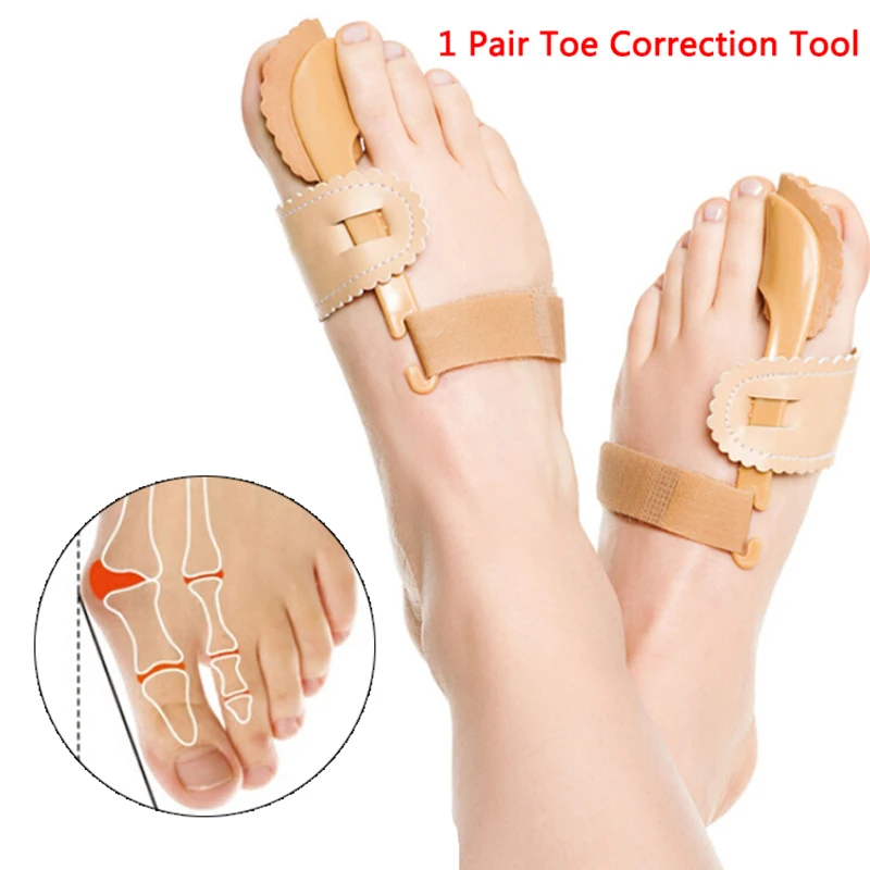 

Bunion Device Hallux Valgus Orthopedic Braces Toe Correction Night Foot Care Corrector Thumb Goodnight Daily Big Bone Tools