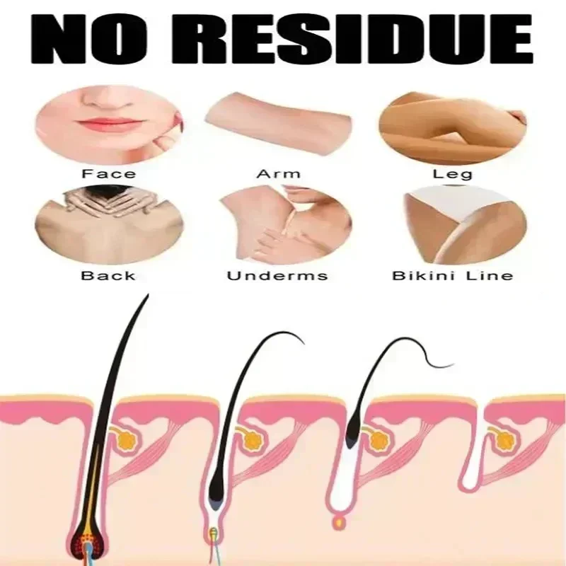 Спрей для быстрого удаления волос в течение 2 минут ингибитор безболезненного