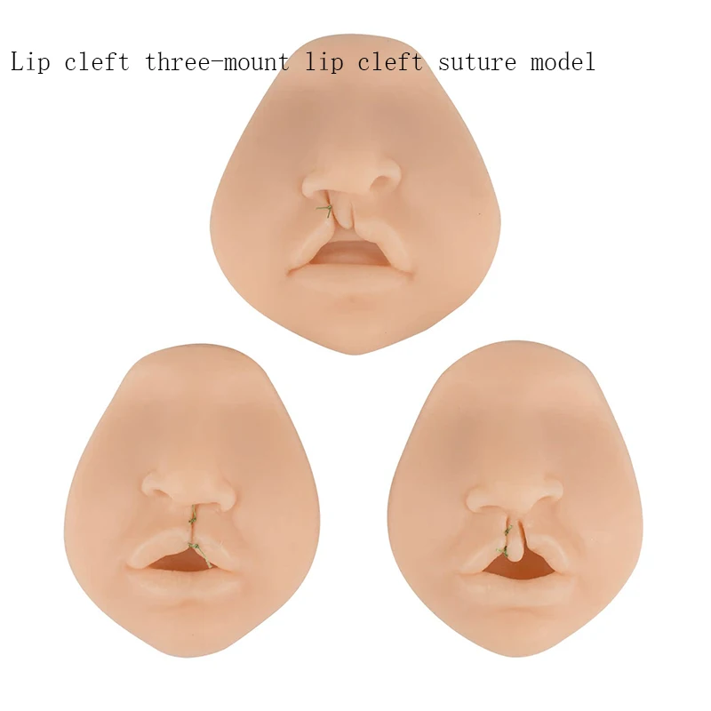 Учебная модель с расщелкой губ, модель кроличьей губы, медицинская ирургия полости рта, односторонняя двусторонняя модель упражнений для наложения швов губ с расщелкой сергей геннадьевич зотов 365 5 упражнений по чистописанию