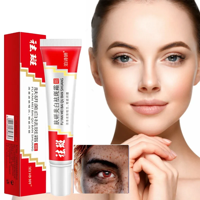 

Freckle Whitening Cream Black Dots Melasma Remover Anti Brown Stain Lighten Pigmentation Moisturizing Korean Skin Care Products