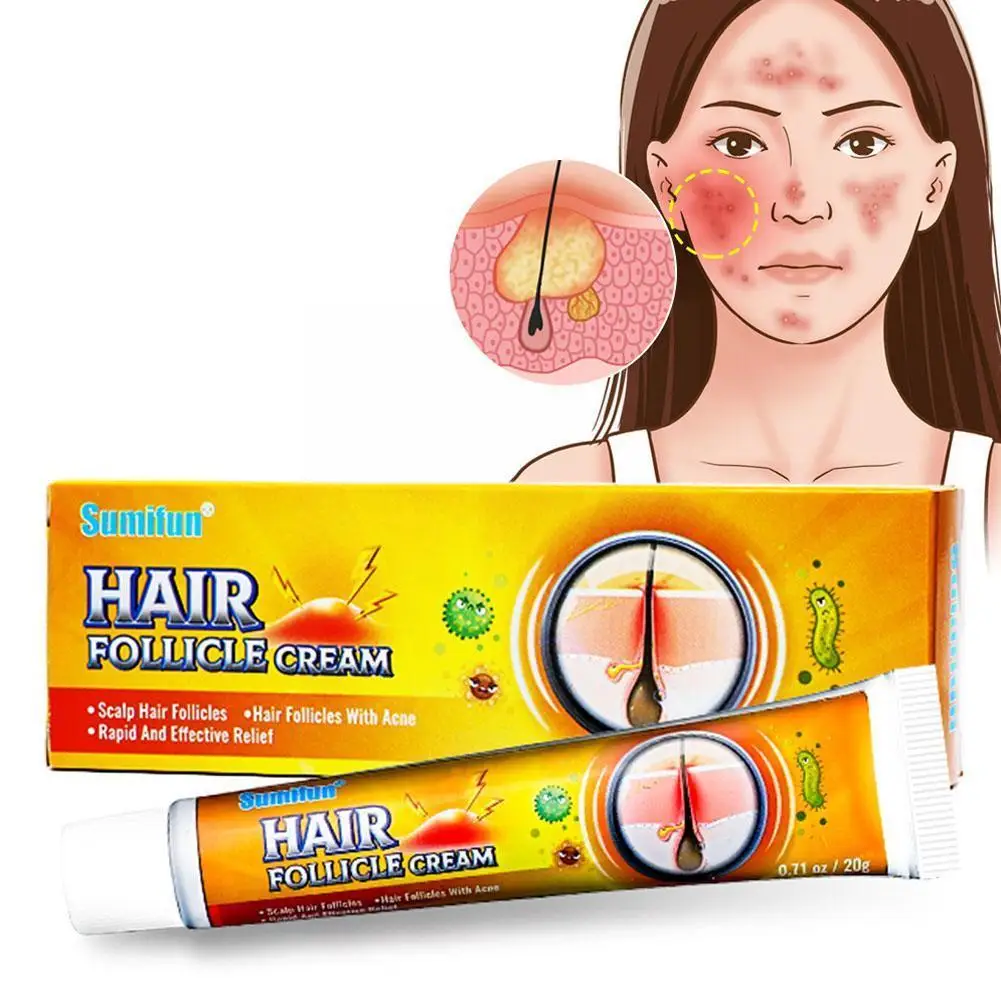 

20g Folliculitis Cream Scalp Hair Folliculitis Treatment Remover Cysts Pustules Ointment Ulcers Skin Spot Ointment Papules I8H8
