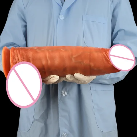 Писка фотосынан ағып жатқан әйел сперматозоидтары