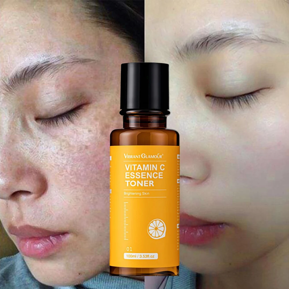 

Vitamin C Toner Whitening And Yellowing Brighten Tighten Control Oil Moisturize Hydrating Repair Soothe Soften Improve Skin Tone