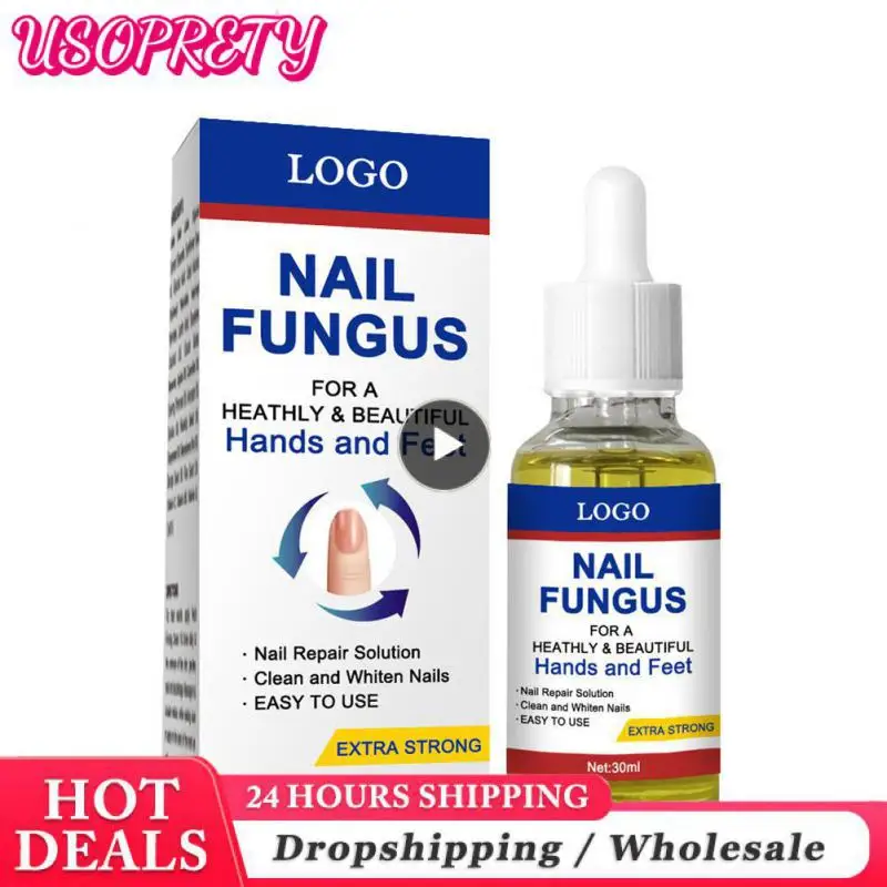 

Антигрибковая Сыворотка для ногтей, восстанавливающая Жидкость против паронихии и онихомикоза, отбеливающая Сыворотка для ногтей на ногах, гель для удаления ногтей, уход за ногами