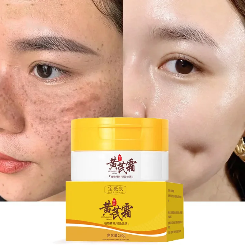 

Astragalus Whitening Freckle Cream Fade Dark Spots Acne Anti-aging Lift Firming Moisturizing Improve Dullness Brighten Skin Care