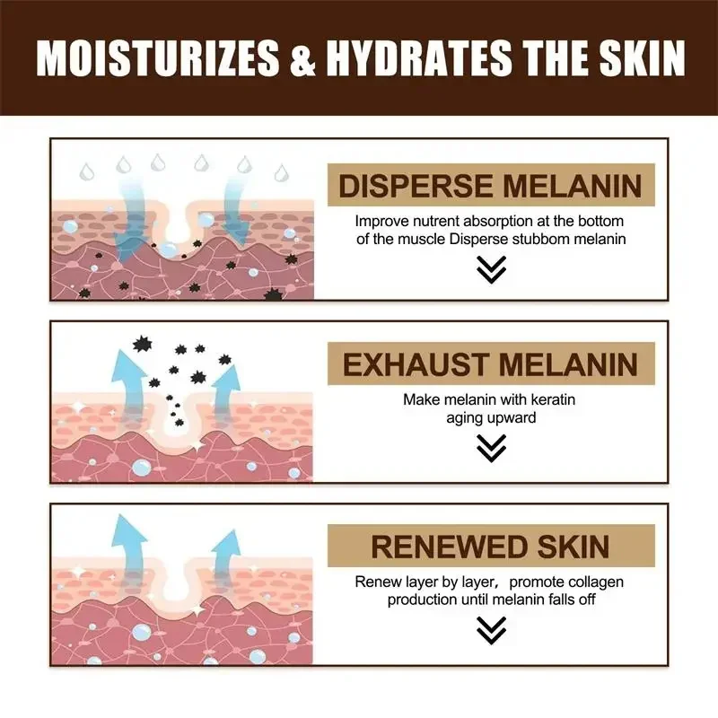 Мощный отбеливающий крем для удаления пятен осветляющий кожу быстрое устранение