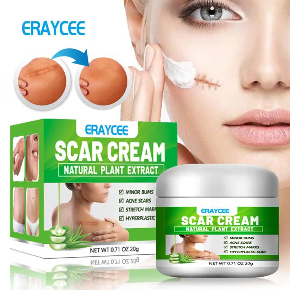 

20g Aloe Scar Removal Cream Acne Scar Spot Removal Gel Burn Cream Treatment Skin Repair Face Care Cream Blemish X8M2
