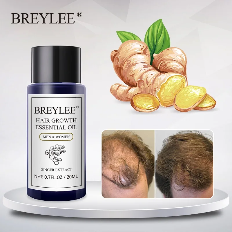 BREYLEE Hair Growth Essential Oil Hair Loss Product for Man Woman Hair Regrowth Prevent Baldness Scalp Nourishing Hair Serum 20g