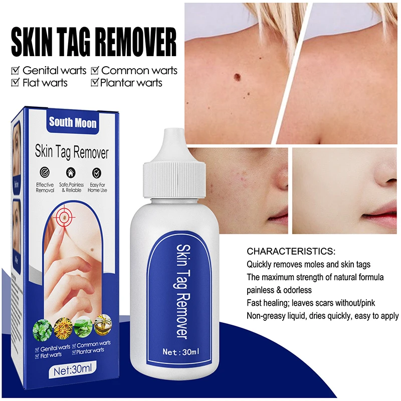 

10ML Skin Tag Remover Genital Wart Treatment Instant Removal Mole&Papillomas Foot Corn Repair Tool Natural Bacteriostatic Liquid