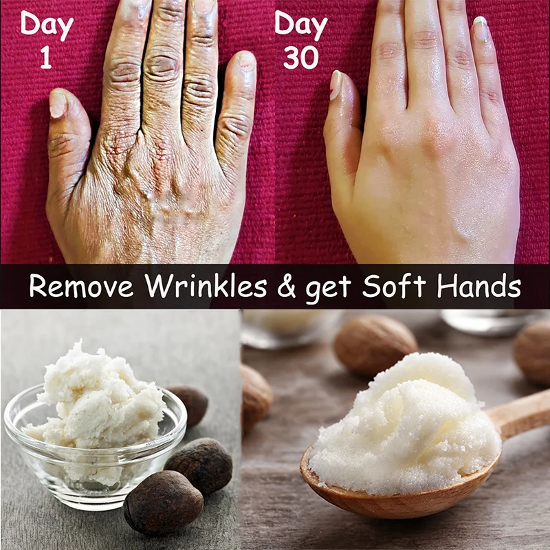 

Africa Shea Butter Remove Wrinkles From Hands Wrinkle-free Moisturizing Cream Dry Skin Smooth Fair Hands Get Baby Soft Hands