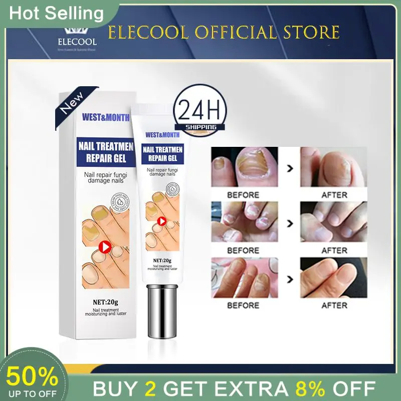 

Мягкий крем для ногтей с онихомикозом, 20 г, крем для ухода за ногтями, удаление лака и ног, онихомикоз TSLM1