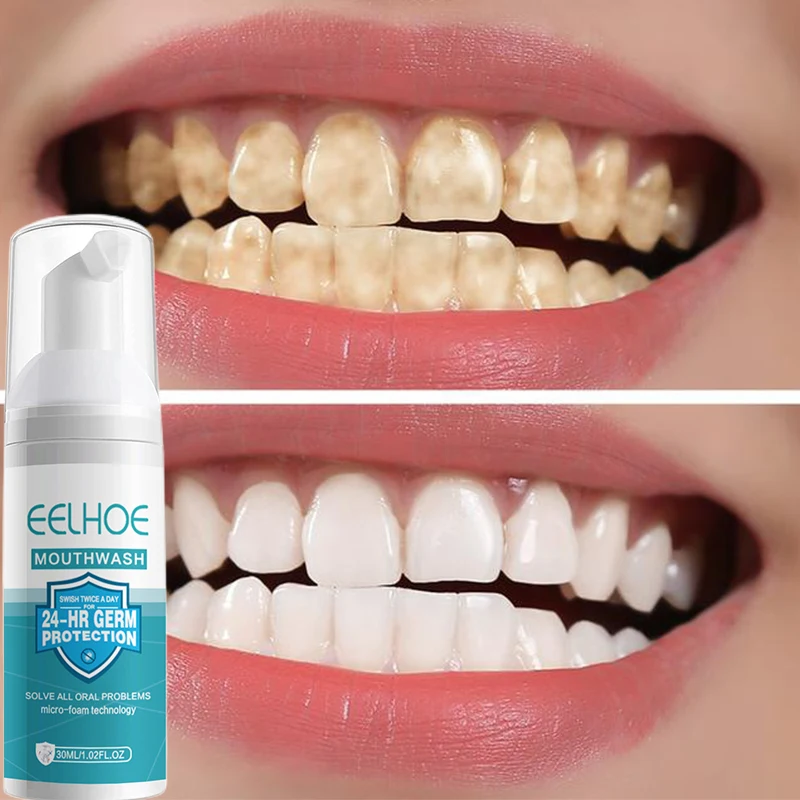 Teeth Whitening Mousse Professional Dental Whitening Products Toothpaste Tartar Removal  Deep Cleaning Personal Health Care30ML