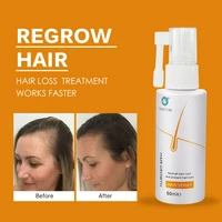 haircube fast anti hair loss hair growth spray essential oil liquid for men women hair growth essence serum hair care repair