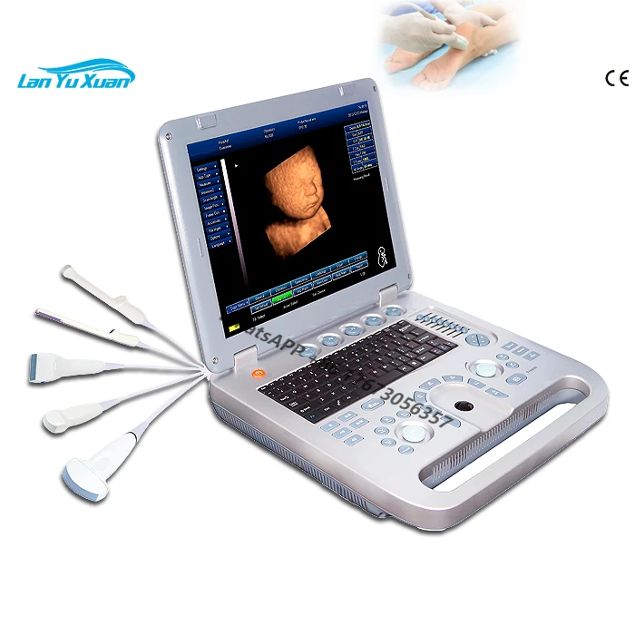 

OBGYN 3D baby scanner ultrasound portable pregnancy scanning ultrasound