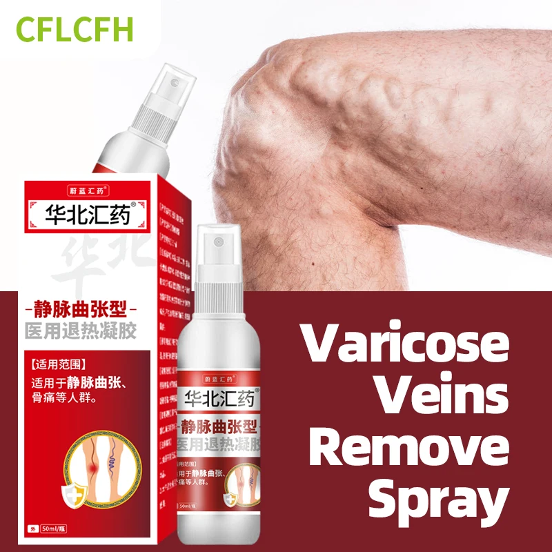 Средство для удаления варикозного расширения вен 50 мл