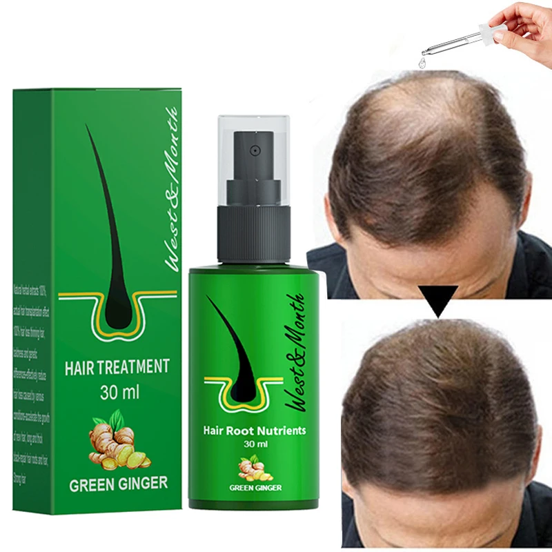 Hair Growth Products for Men Women Promote Hair Regrow Fast Prevent Hair Loss Strengthen Follicles Hair Care Essential Oils 30ML