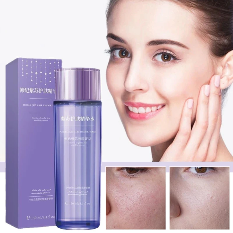 

130ml Essence Water perilla Repair oil control Improve Dull Whitening smoothing Moisturize Dry Skin Facial Beauty Care Toner