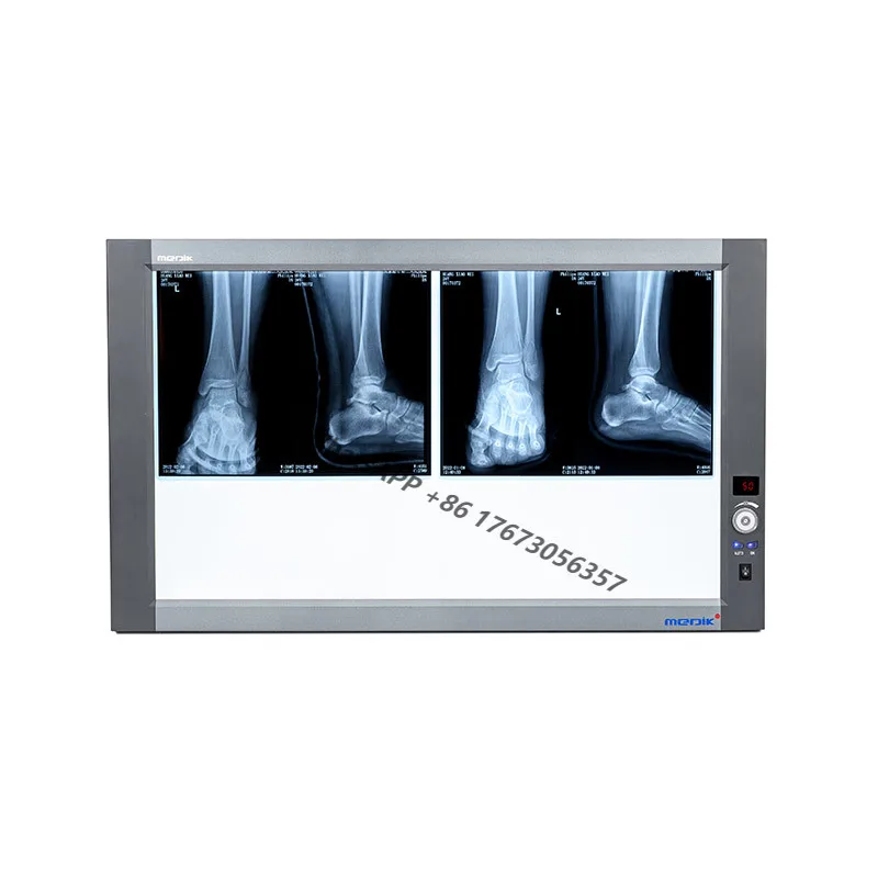 

Adjustable Medical LED X Ray Imaging Film Viewer Double panel led negatoscope