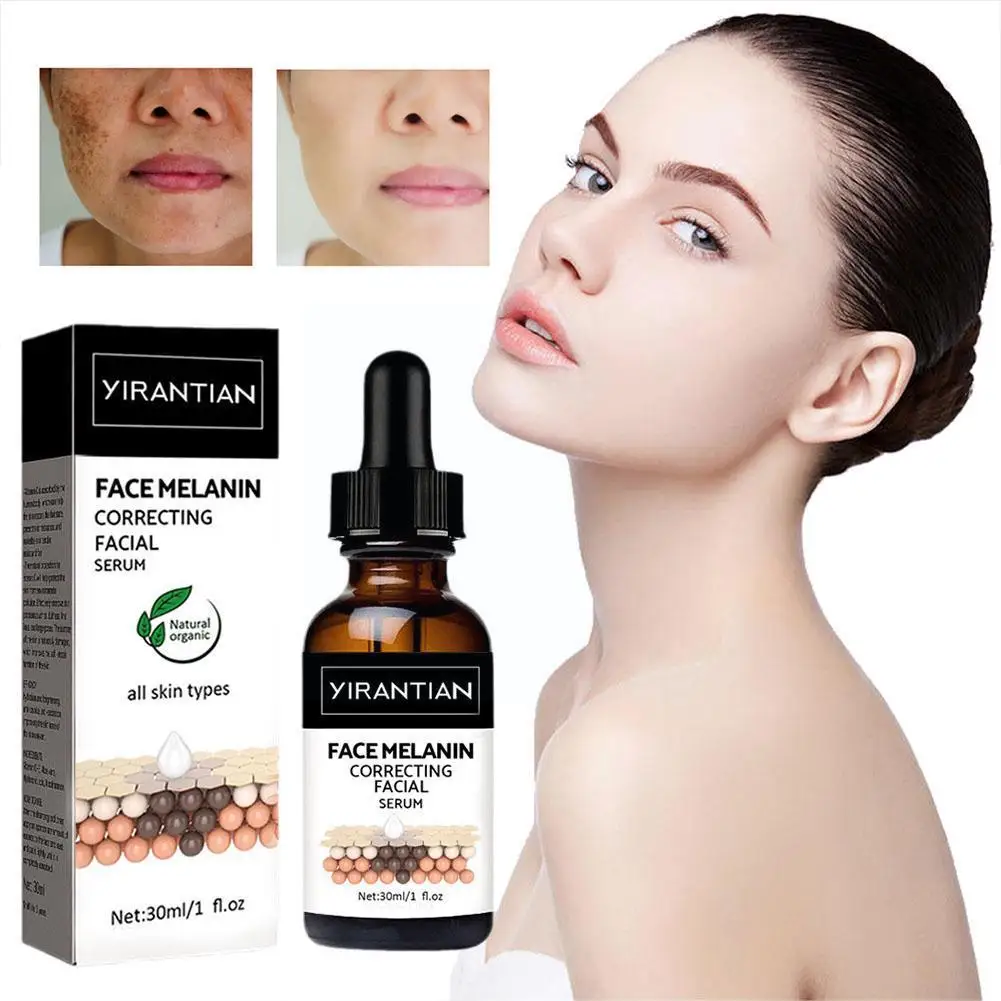 

Effective Whitening Freckle Serum Removal Melasma Acne Moisturizing Skin Spots Dark Pigment Fade Melanin Corrector Care Bri O5R0