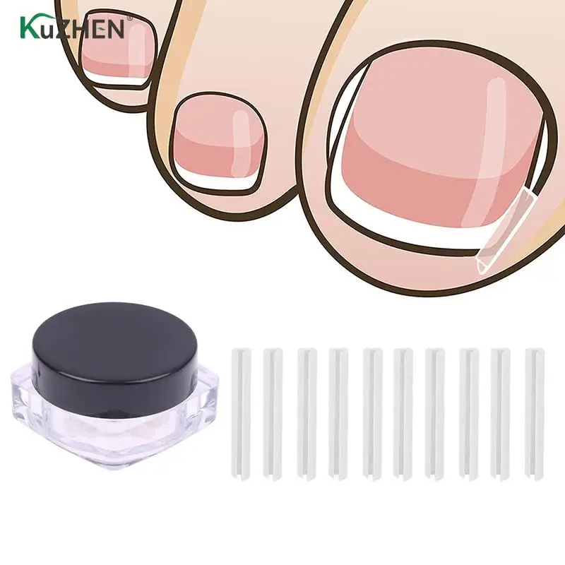 

10 шт., лента для выпрямления ногтей