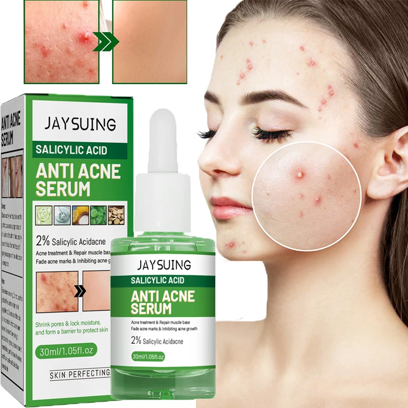 

Anti acne Face Serum Moisturizing Salicylic Acid Pimple Scar Blackhead Removal Shrink Pores Oil Control Acne Treatment Skin Care