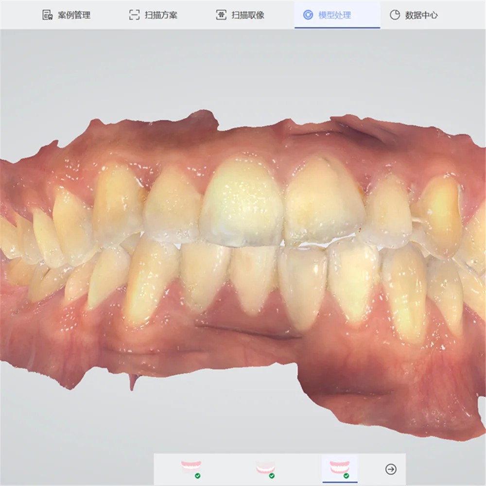 Рисунок 5 - Интраоральный 3d-сканер Pingtum