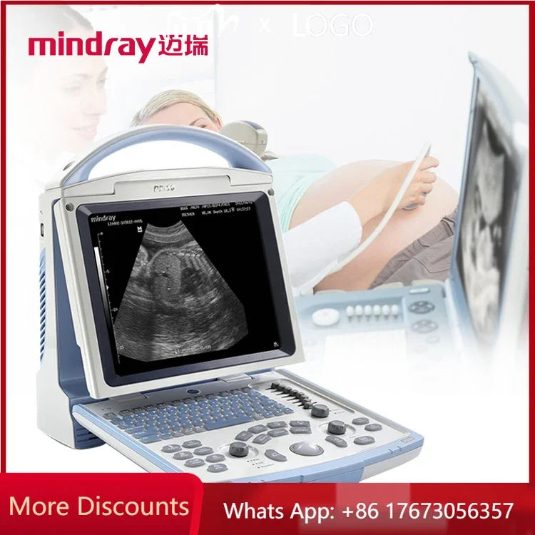 Портативный медицинский ультразвуковой аппарат Mindray Sonografo Portatil Ecografo Dp 10