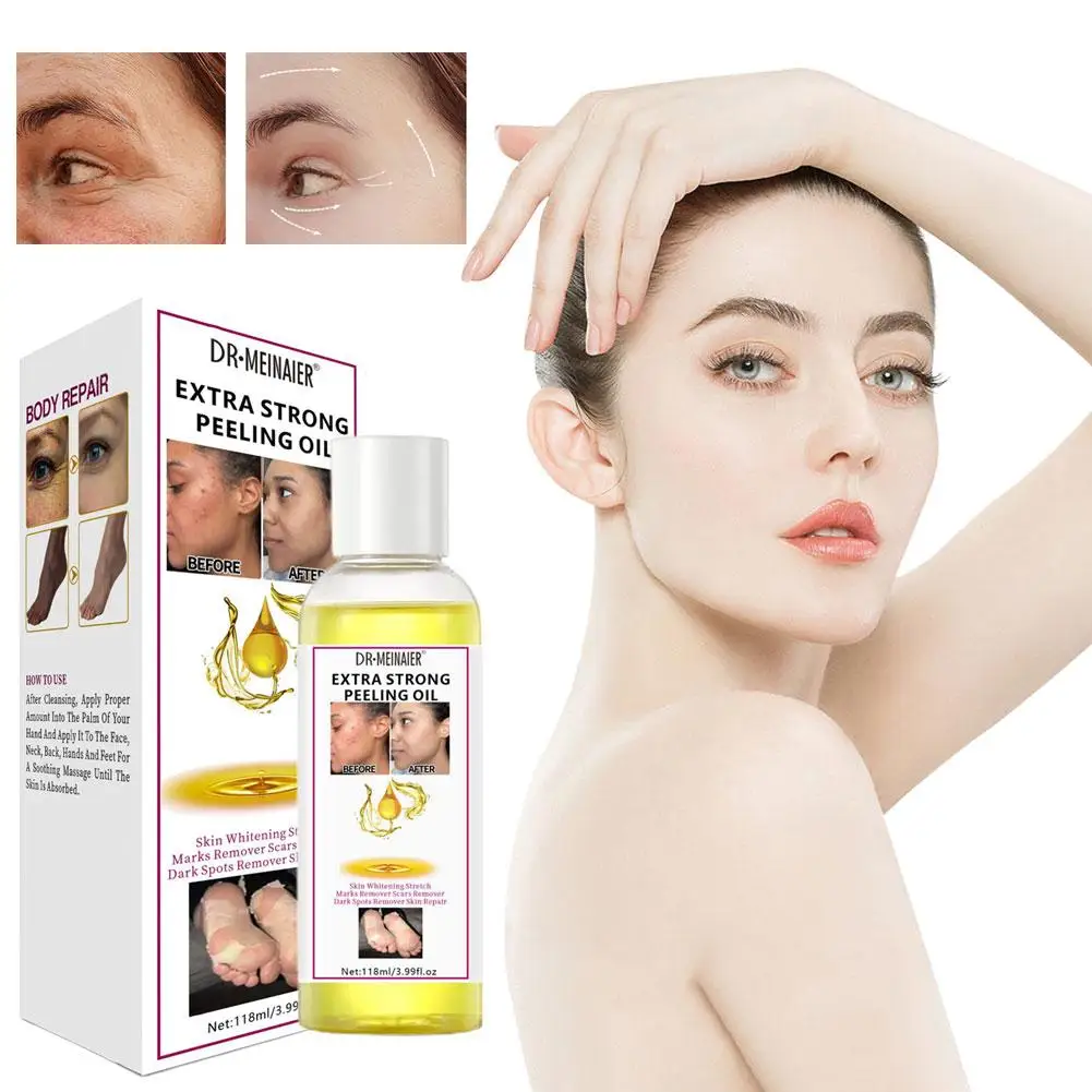 

Super Strength Yellow Peeling Oil Black Skin Strong Whitening African Skin Whiten Bleaching Yellow Oil Skin Peeling Remover D7M7