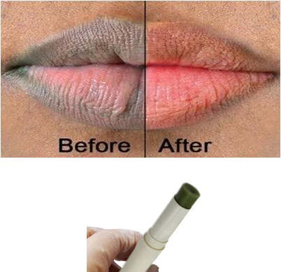 

1pcs Lips Pink Fresh Lightening Bleaching Cream Treatment Remove Dark Smoke Lips lip oil