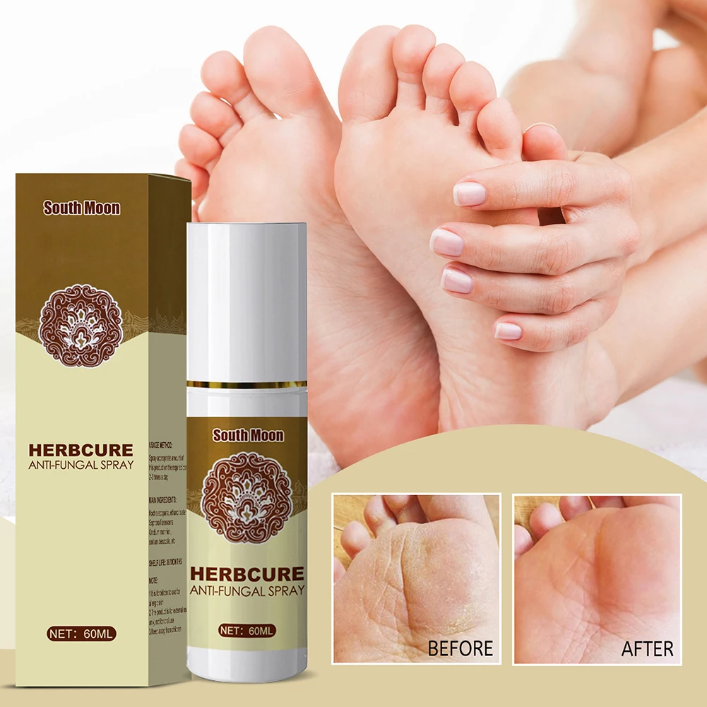 

30ml Fungal Combat Feet Spray Foot Sterilize Spray Herbal Anti-Infection Toe Treatment Onychomycosis Foot Care Tools