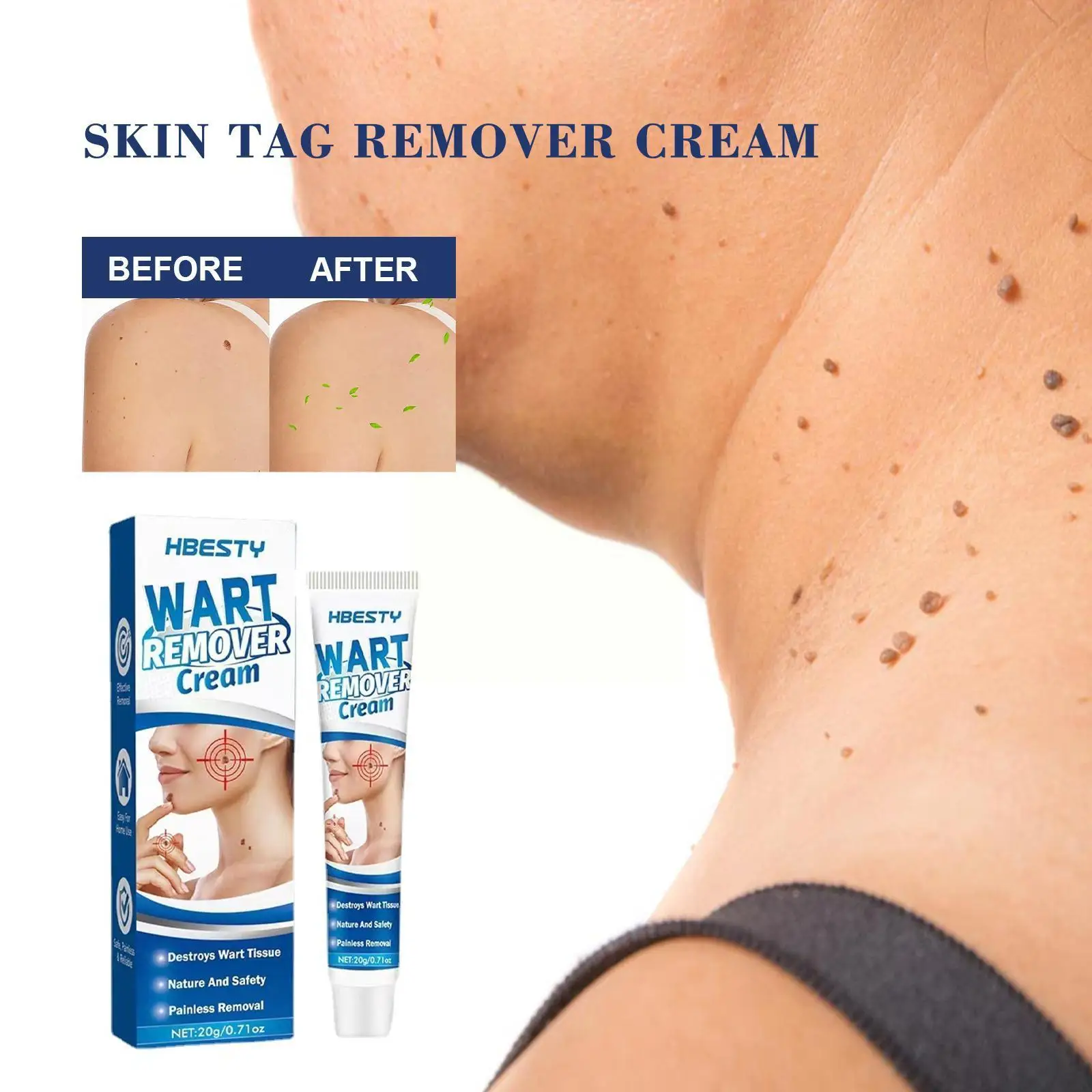 

Skin Tag Remover Cream Painless Mole Skin Dark Spot Removal Treatment Warts Face Wart Oil Tag Freckle Essential Remover Ser A3M1