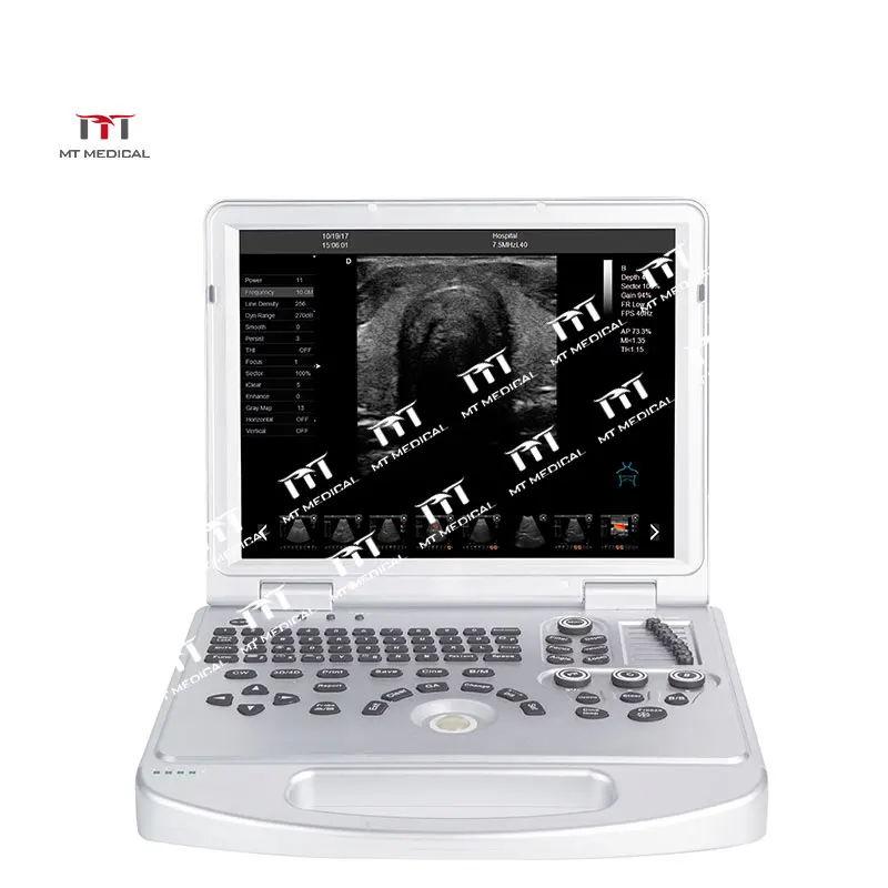 

MT Medical CE 12 Inch LED Ultrasound Echocardiography Echo Laptop 4d Portable Ultrasound Machine