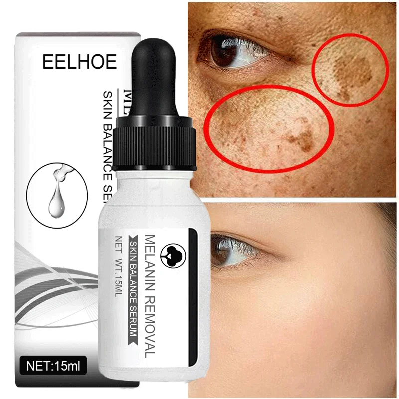 Niacinamide Whitening Serum Remove Dark Spots Freckle Essence Anti-Aging Fade  Melanin Correcting Facial Beauty Skin Care 30ml