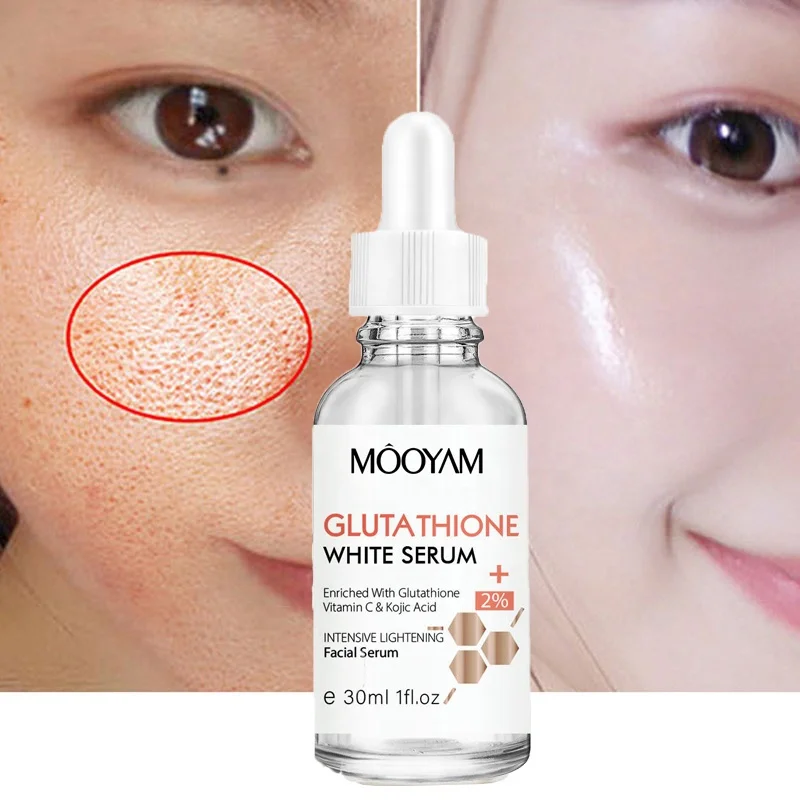 

Glutathione Whitening Freckle Serum Remove melasma Dark Spots Anti-acne Brightening Moisturizing Vitamin C Essence SkinCare 30ml